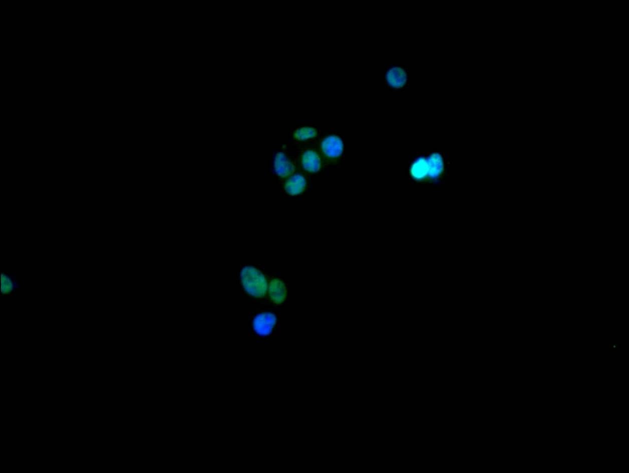 hnRNP C1 + C2 Antibody (9G1)