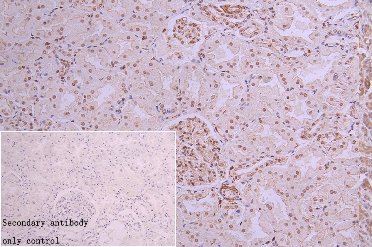hnRNP C1 + C2 Antibody (9G1)