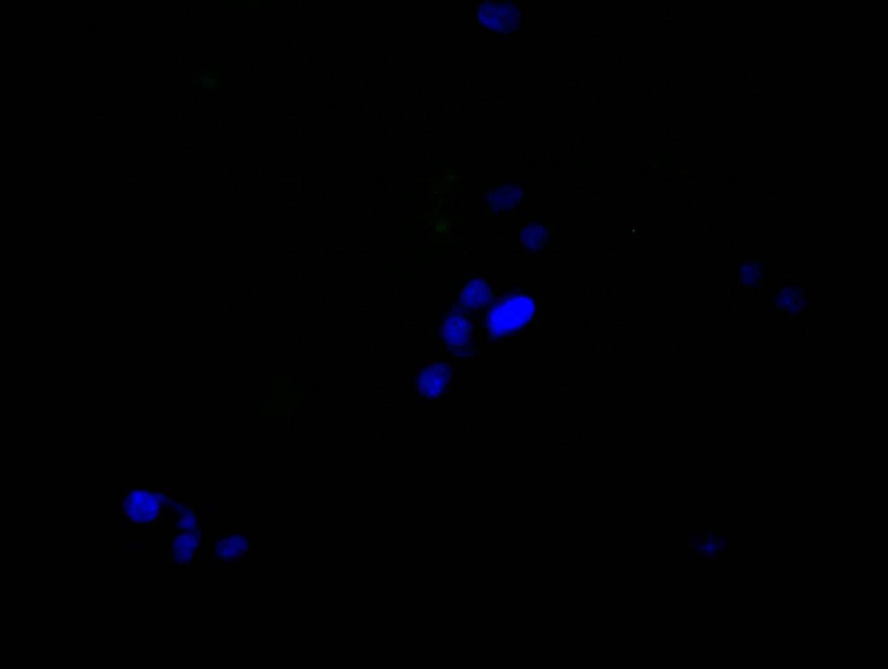 hnRNP C1 + C2 Antibody (9G1)