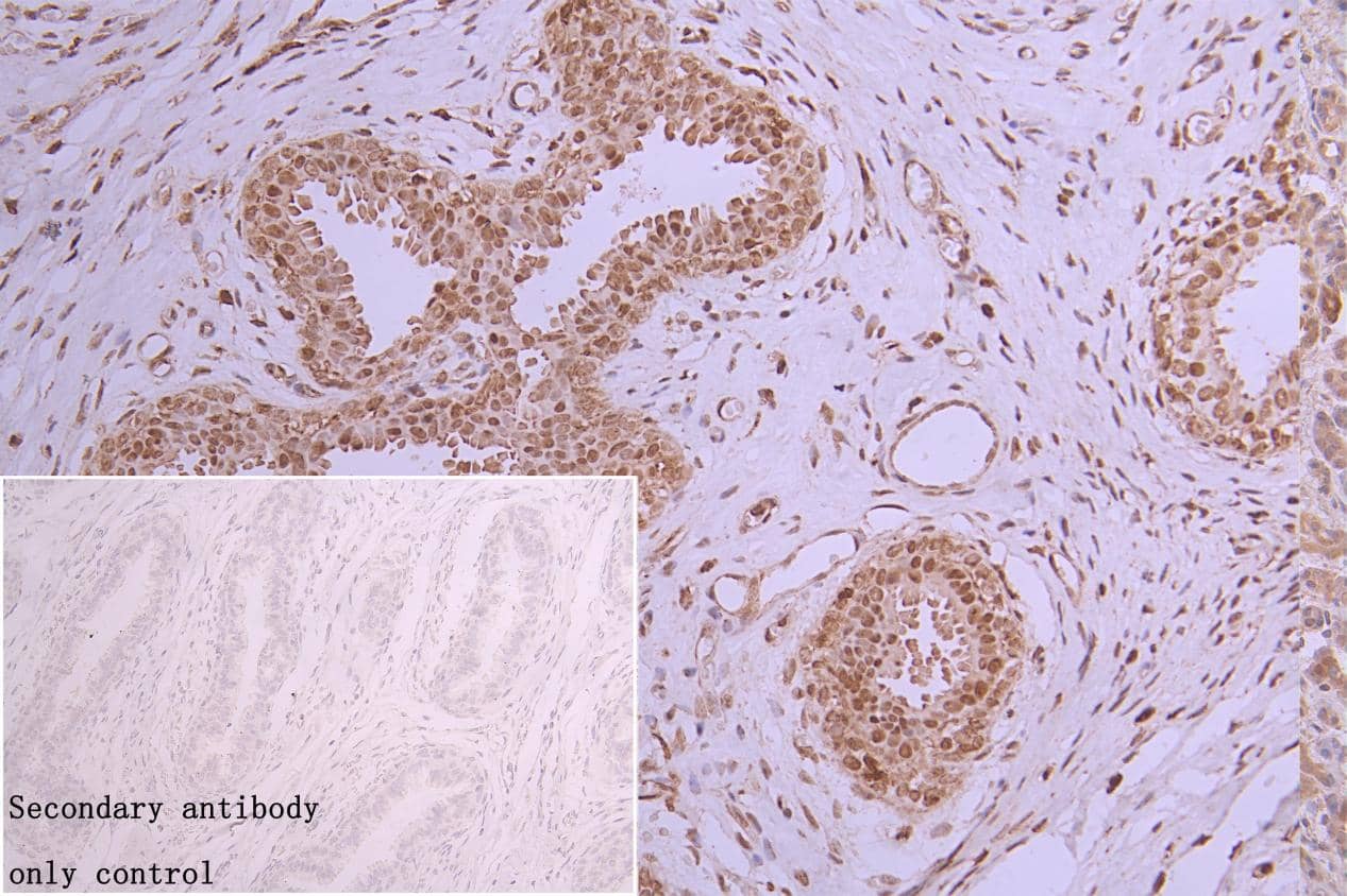 hnRNP C1 + C2 Antibody (9G1)