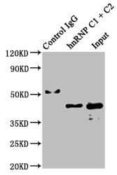 hnRNP C1 + C2 Antibody (9G1)