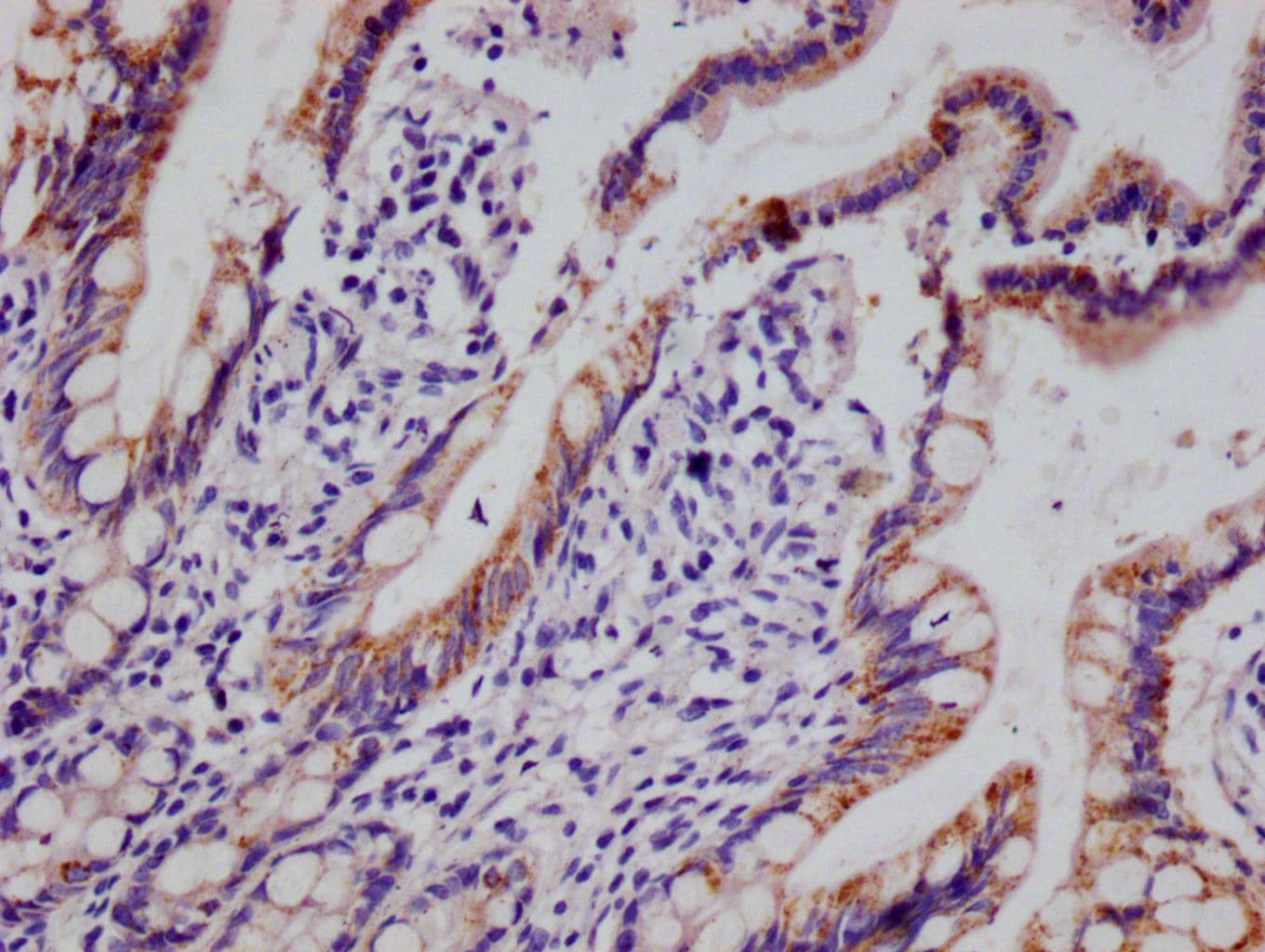 HMGCS2 Antibody (19C11)