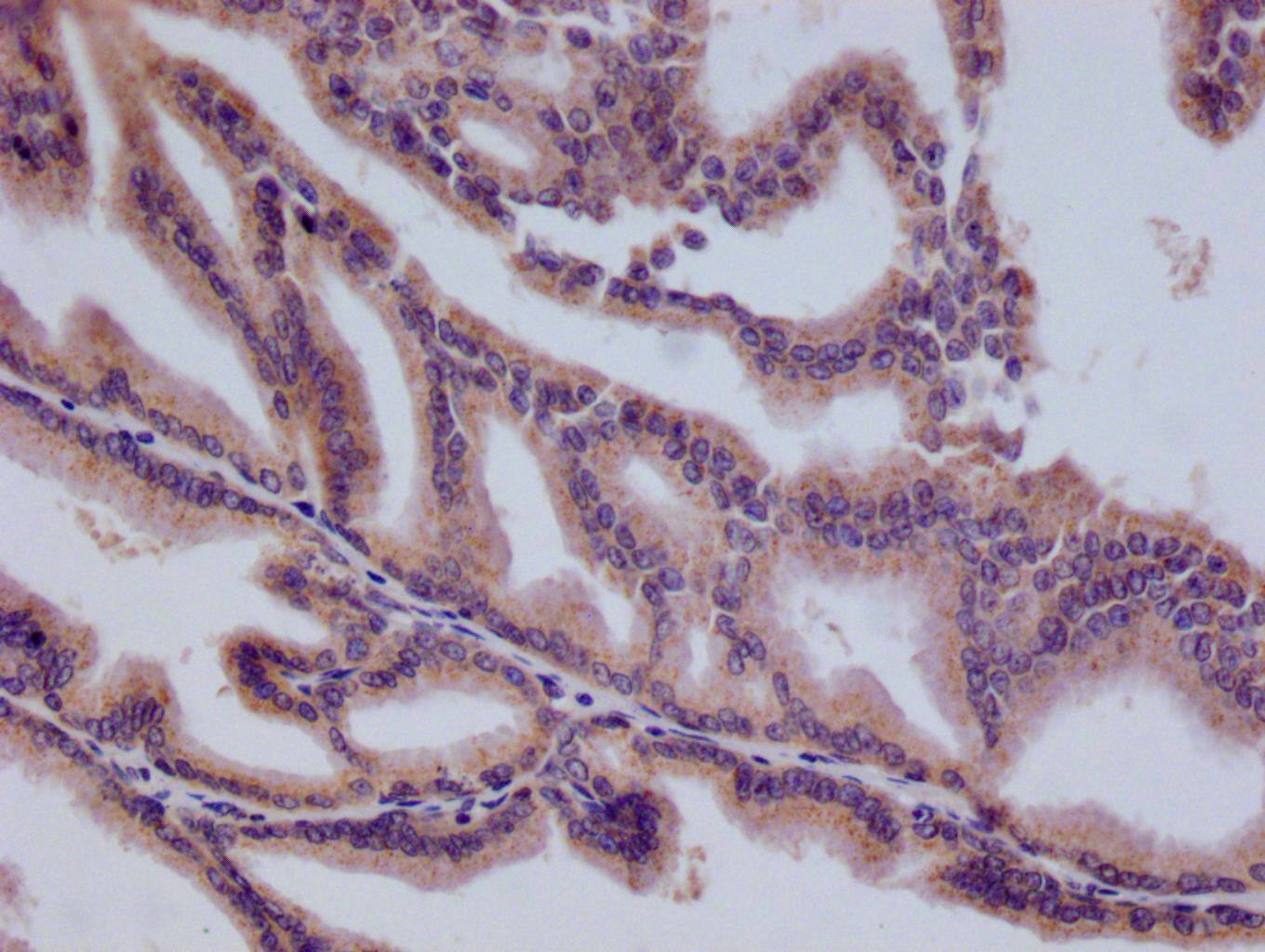 HMGCL Antibody (22H11)