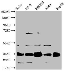 HMGCL Antibody (22H11)