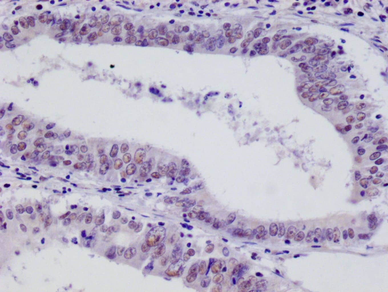 FIH-1/HIF-1AN Antibody (12F11)