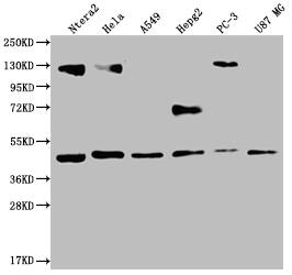 FIH-1/HIF-1AN Antibody (12F11)