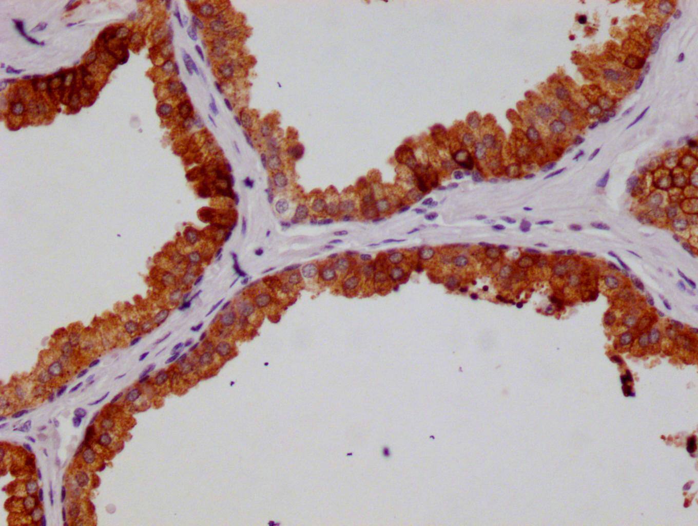 HGD Antibody (20D12)