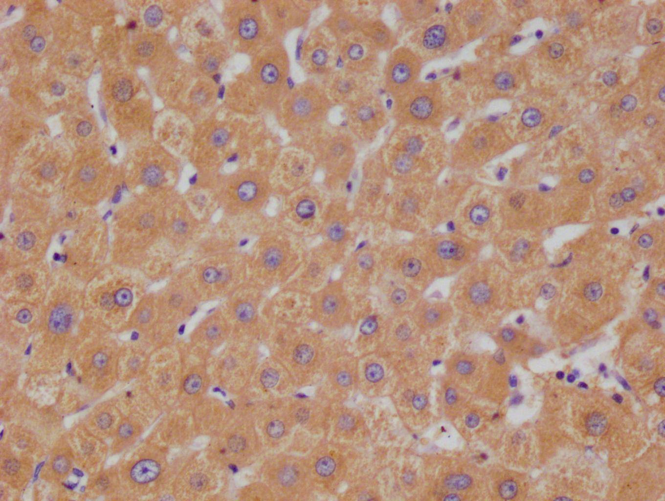HGD Antibody (20D12)