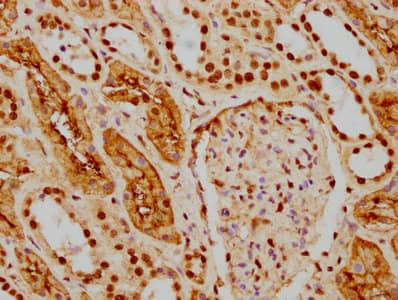 HDAC9 Antibody (1F2)