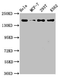 HDAC9 Antibody (1F2)