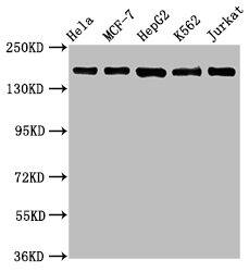HDAC6 Antibody (2H12)
