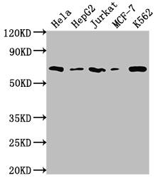 Histone Deacetylase 2/HDAC2 Antibody (9E9)