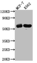 Histone Deacetylase 2/HDAC2 Antibody (9H4)