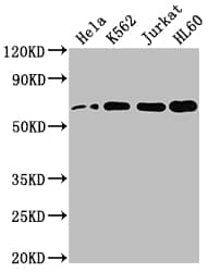 HDAC1 Antibody (10A1)