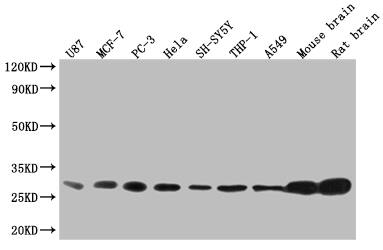 14-3-3 beta/alpha Antibody (6F6)