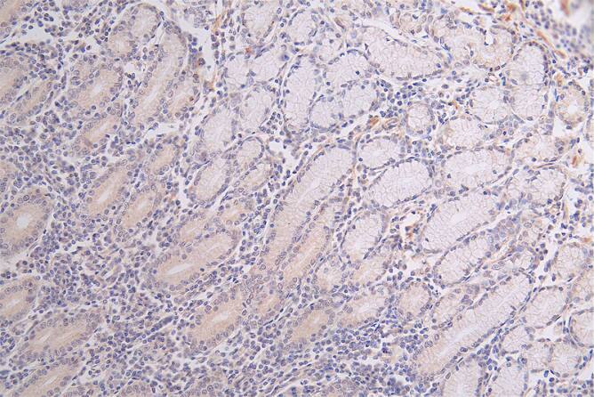 WNK1 Antibody (26G7)