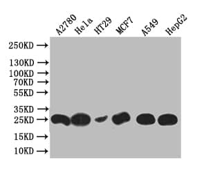 HE4/WFDC2 Antibody (17D2)