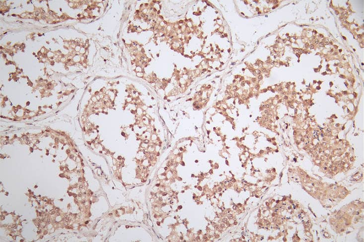 WDR5 Antibody (18D11)