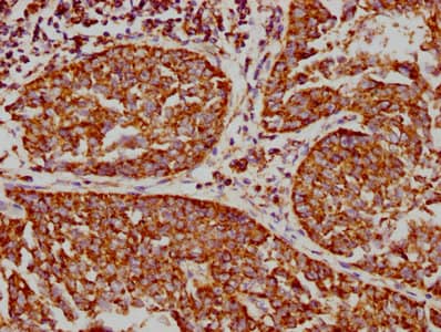 VDAC1 Antibody (3A1)