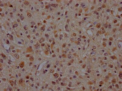 p97/VCP Antibody (5H12)