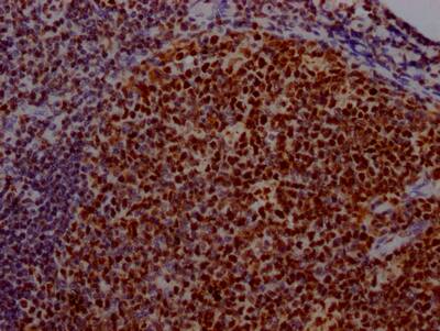 USP7 Antibody (7F10)