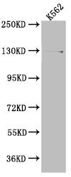 USP7 Antibody (7F10)