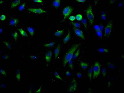 USP7 Antibody (7F10)