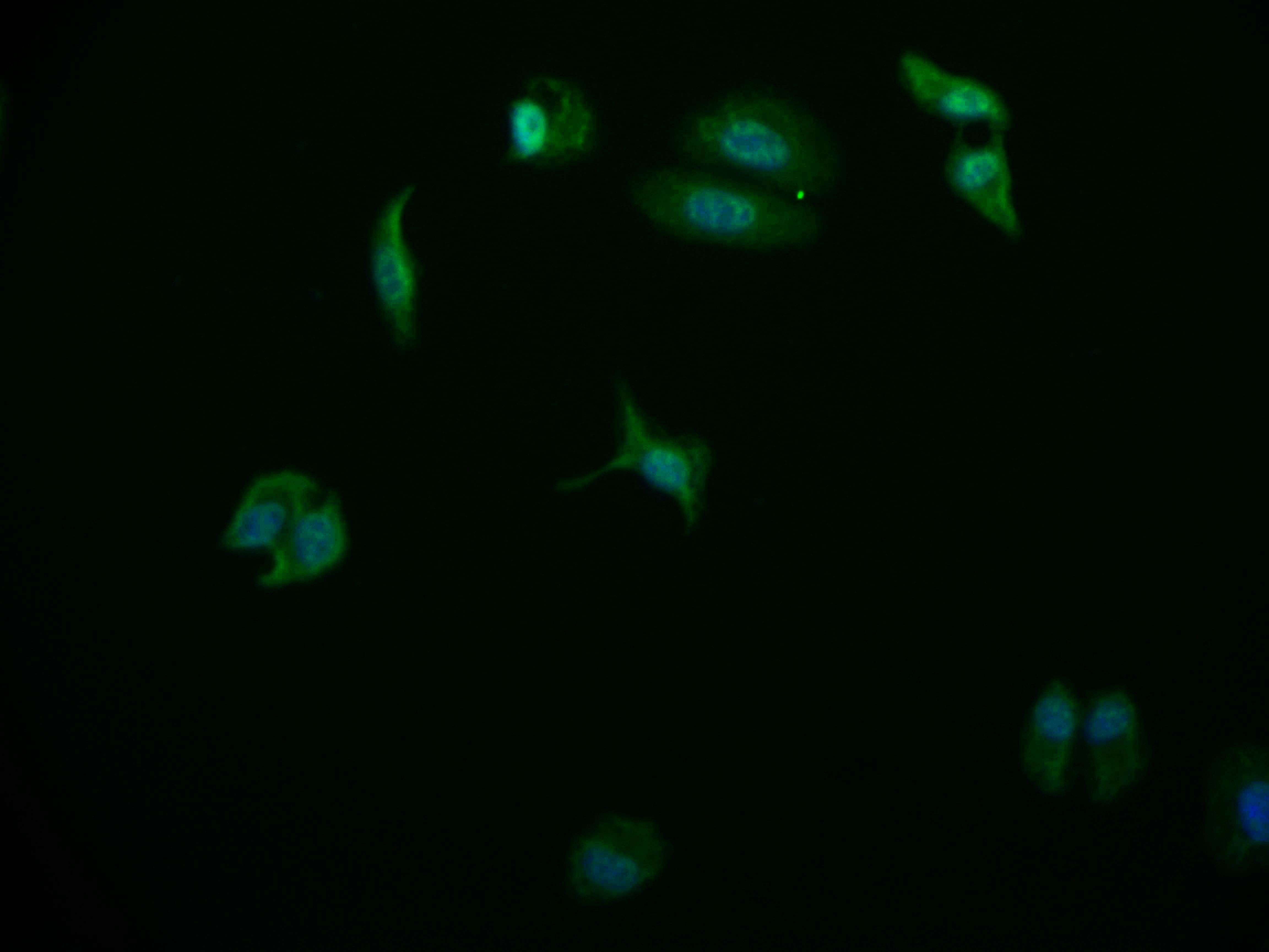 USP24 Antibody (11E3)