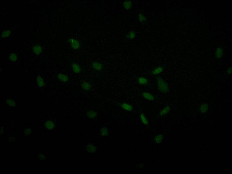 USP22 Antibody (18E3)