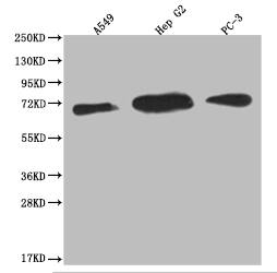 USP22 Antibody (18H6)