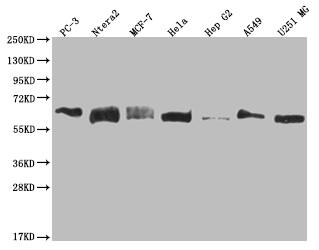 USP14 Antibody (28C4)