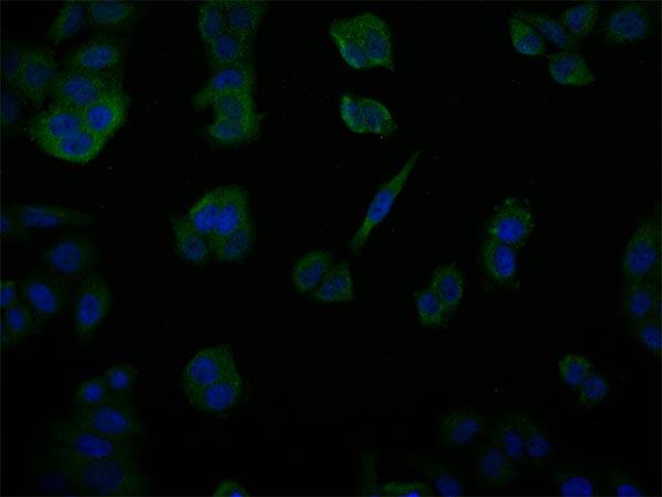 USP14 Antibody (28C4)