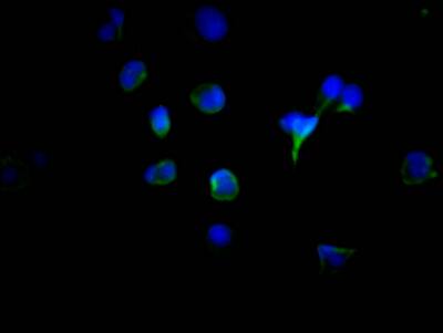 Tyrosinase Antibody (6B2)