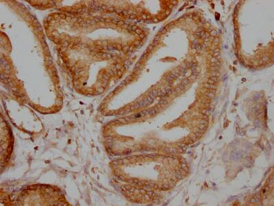 TPT1/TCTP Antibody (10A9)