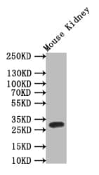 Tryptase beta-2/TPSB2 Antibody (9H6)