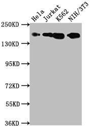 TOP2A Antibody (5B10)