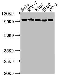 Topoisomerase I Antibody (6D8)