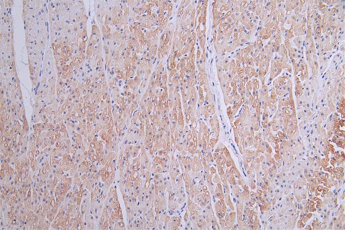 Troponin T Type 2 (cardiac) Antibody (8H8)