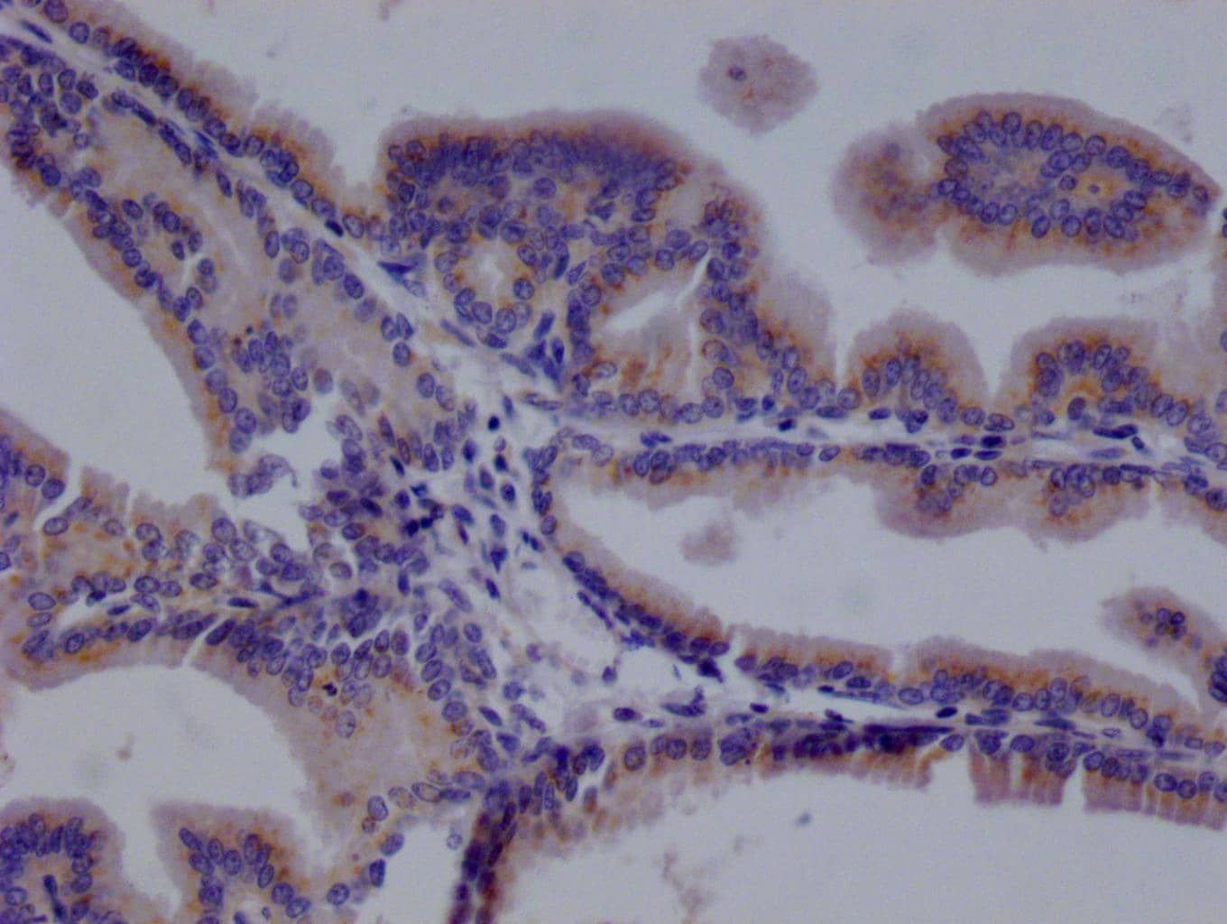 TMEM192 Antibody (21G8)