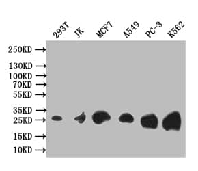 Thymidine Kinase 1 Antibody (6F6)