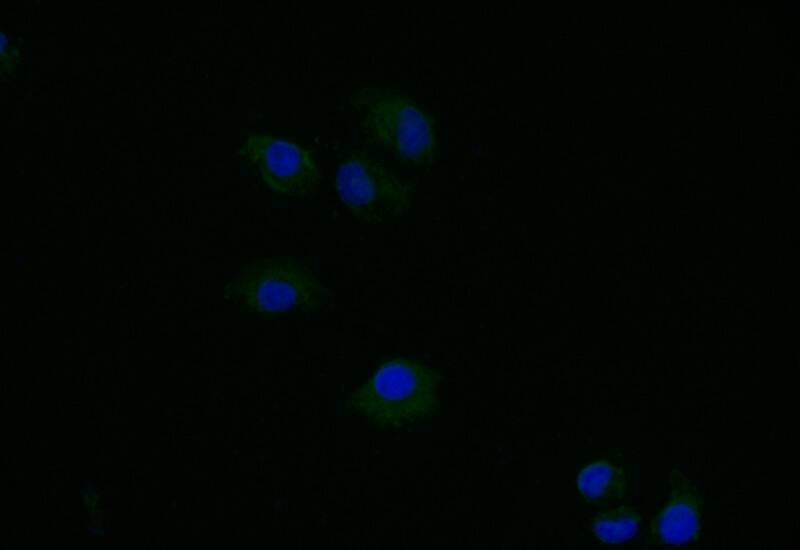 Thymidine Kinase 1 Antibody (6F6)