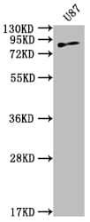 Transglutaminase 2/TGM2 Antibody (7E1)