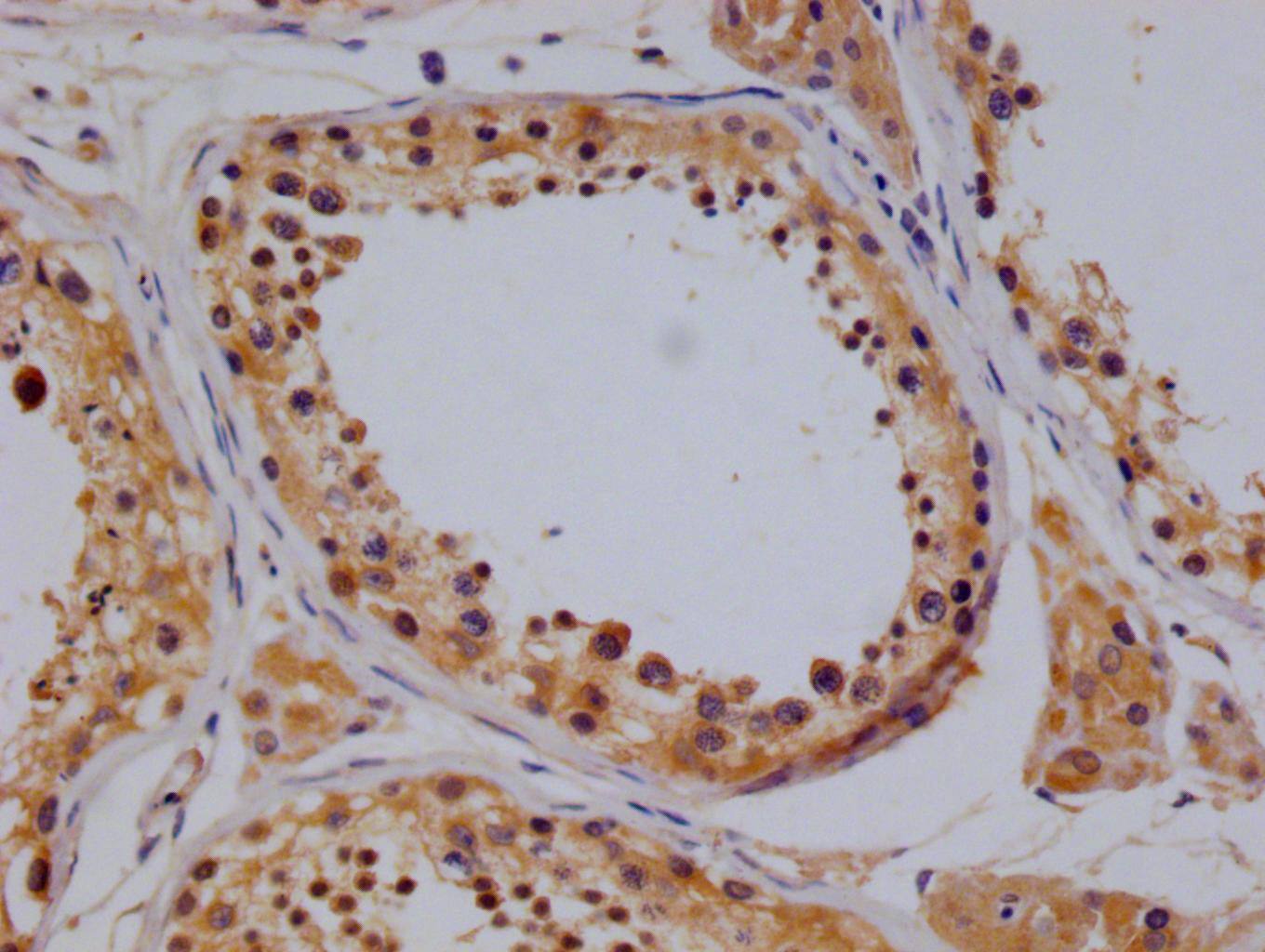 TBK1 Antibody (14D10)