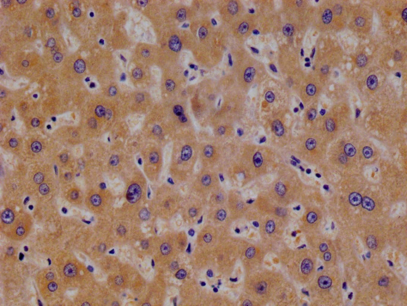TBK1 Antibody (14D10)