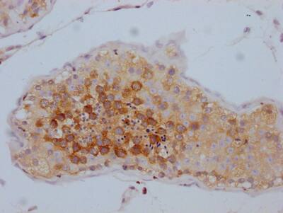 TACC3 Antibody (10G7)