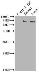 SUZ12 Antibody (1B10)