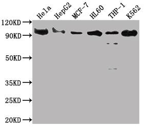 SUZ12 Antibody (1B10)