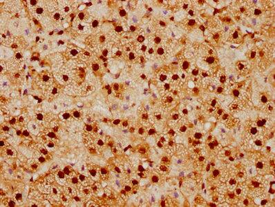 SUMO1 Antibody (5G3)