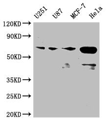 MST2/STK3 Antibody (3C3)