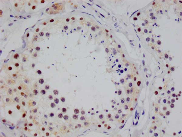 STAT4 Antibody (26G2)